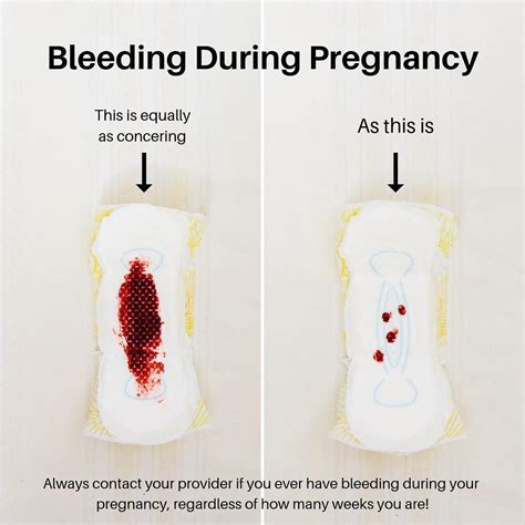 Although vaginal bleeding is not that unusual a symptom, especially in the first 12 weeks of pregnancy, it's a symptom that a woman should . . How much do cervical polyps bleed during pregnancy
